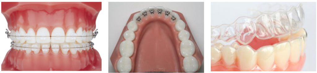 aesthetics-orthodontics