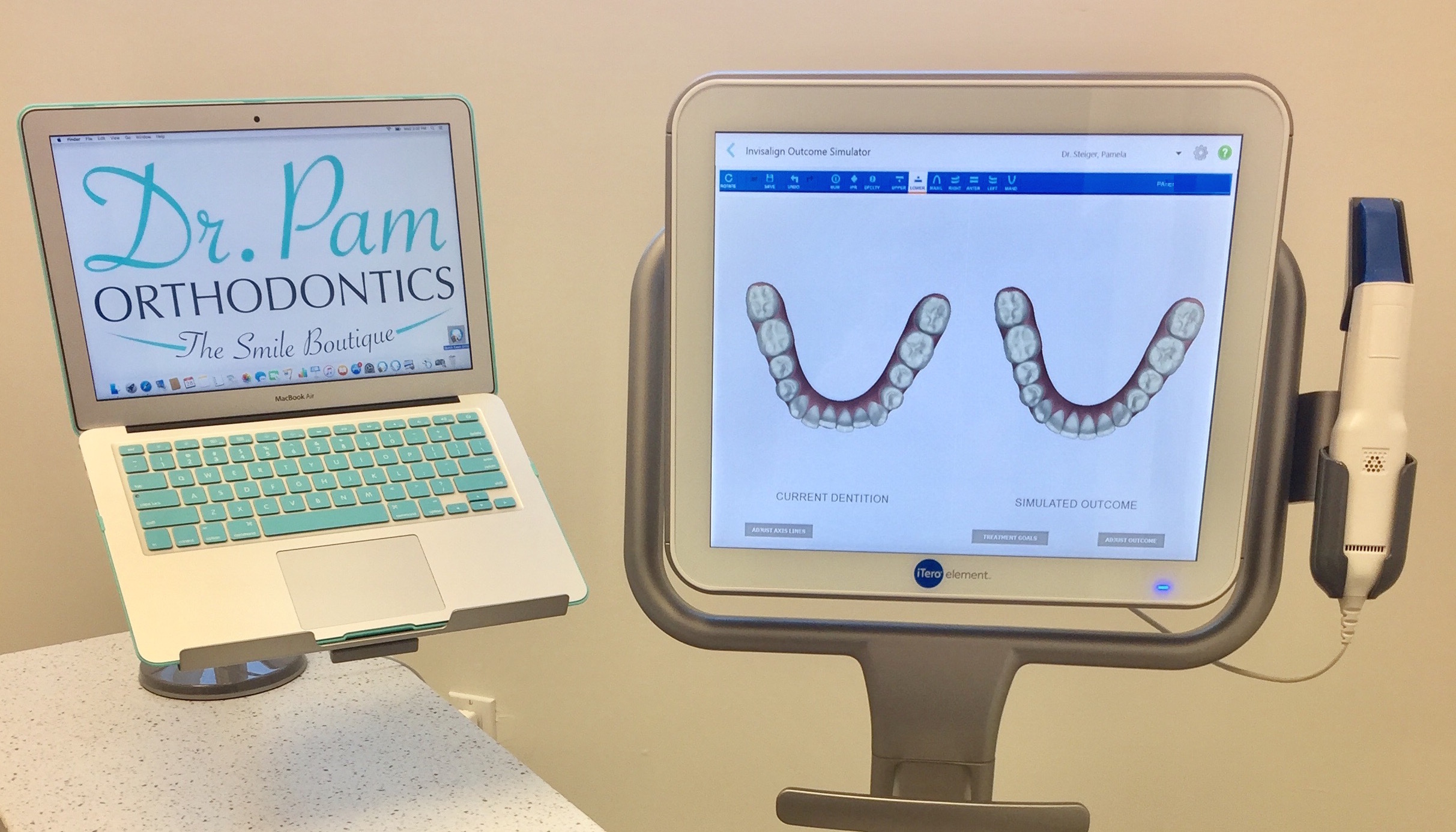 itero-digital-scanner-invisalign.jpg
